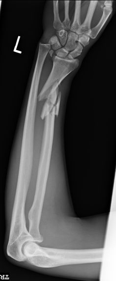 Season 1 Case 16