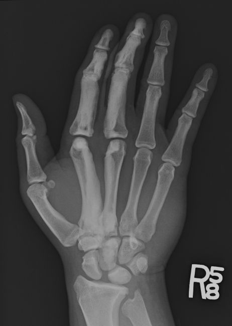 Season 5 Case 32