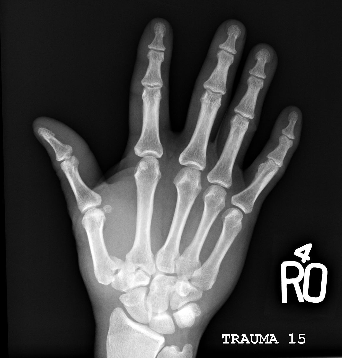 Season 3 Case 11